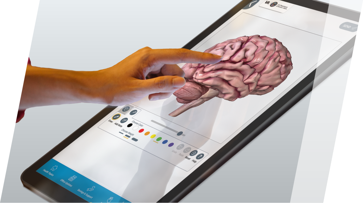 Hand touching a PatientPoint exam room touchscreen displaying a three-dimensional brain anatomical.